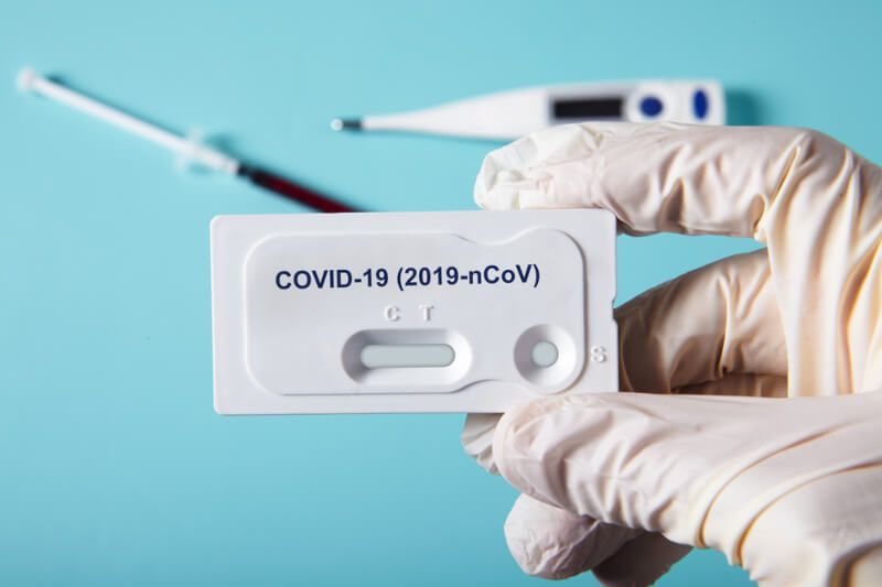 Kiek kainuoja koronaviruso testai? 