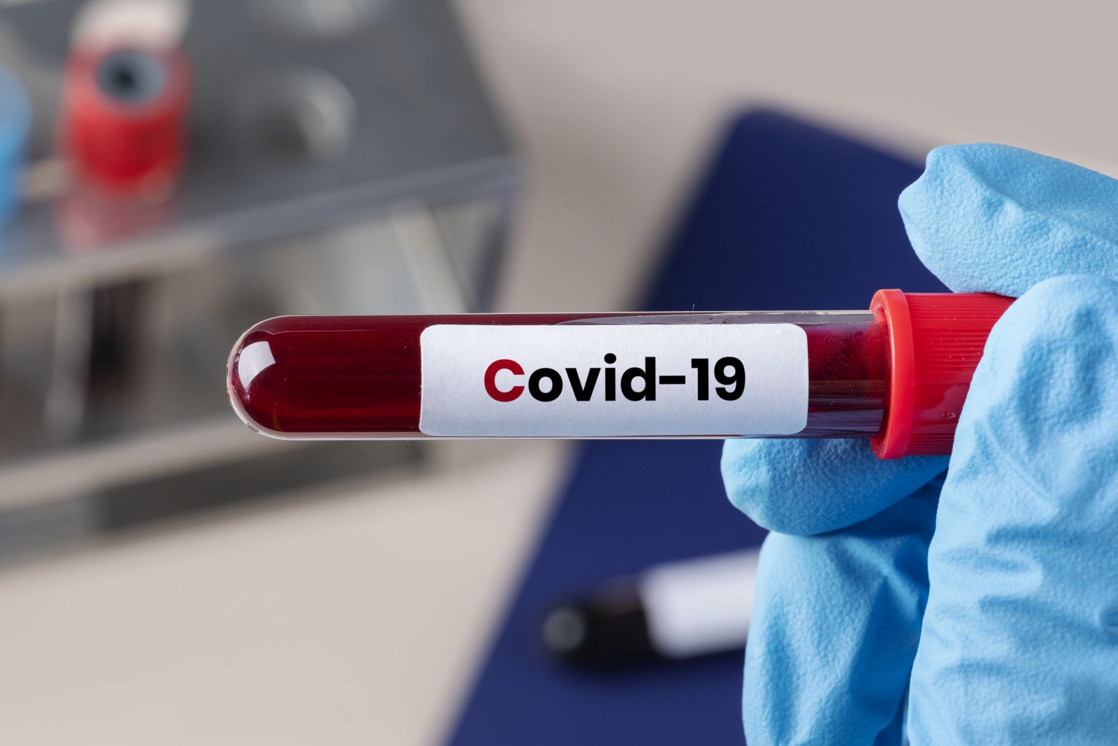COVID-19 testai vis dar vaidina labai svarbų vaidmenį